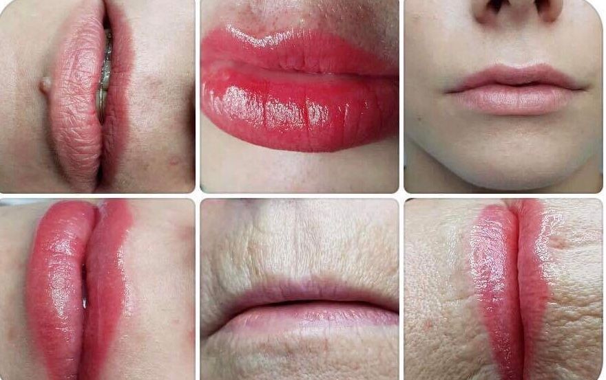 huulten pigmentointi